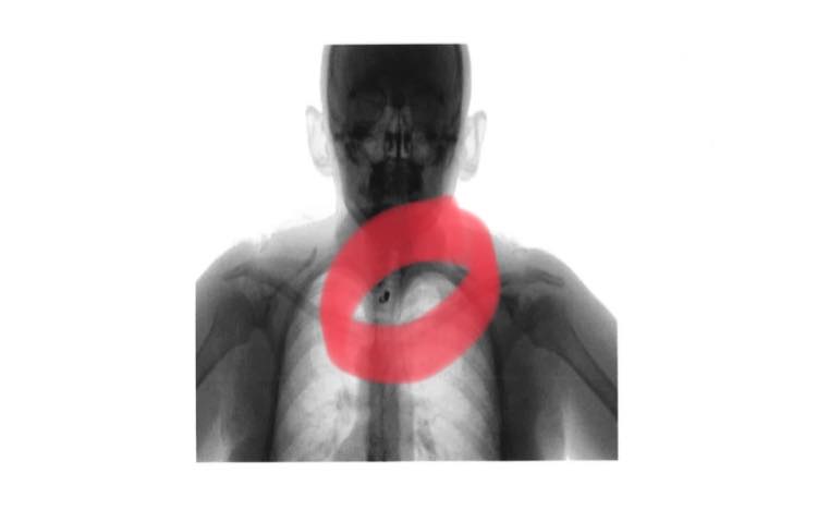 body scan chest.jpg