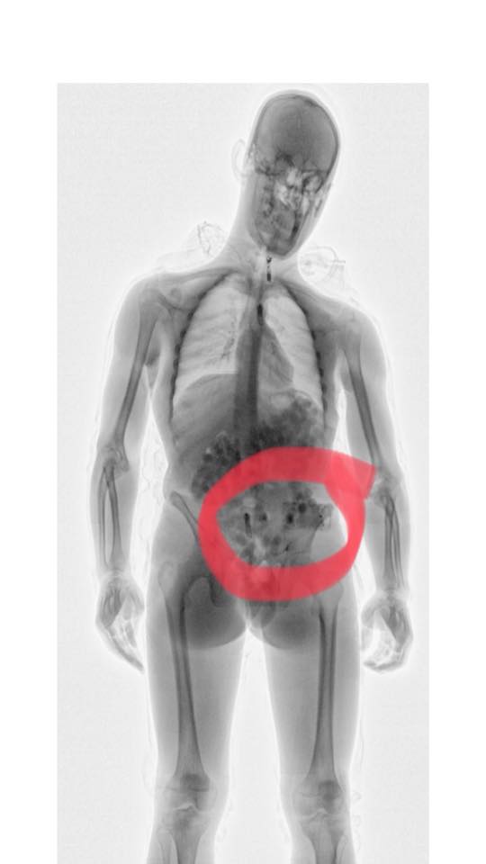 body scan stomach.jpg